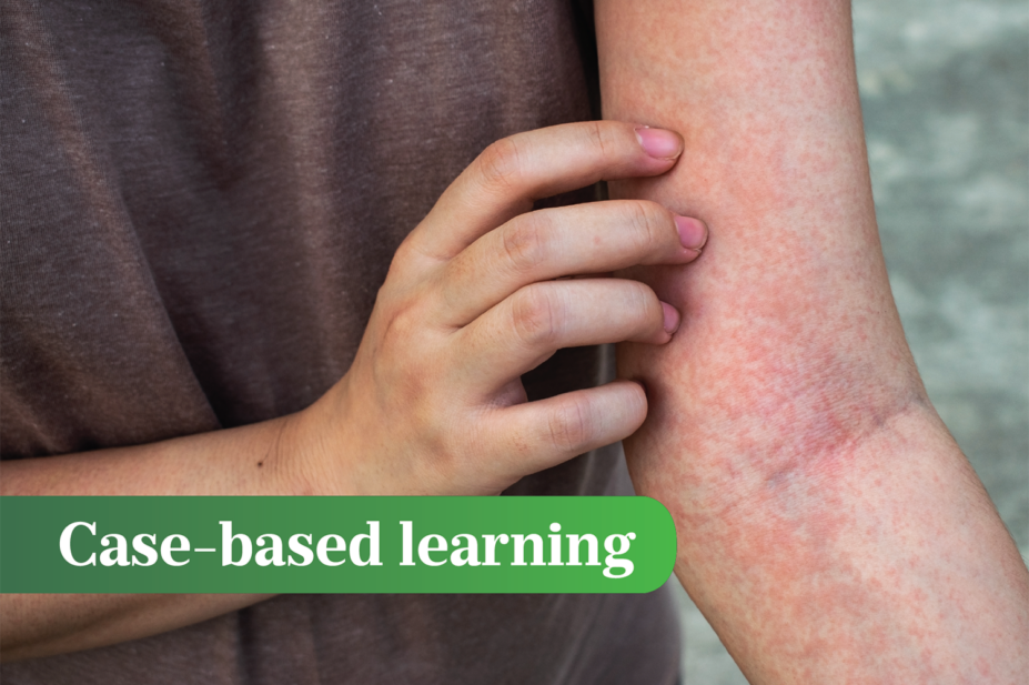 Person holding their arm with their hand, arm covered in red rash