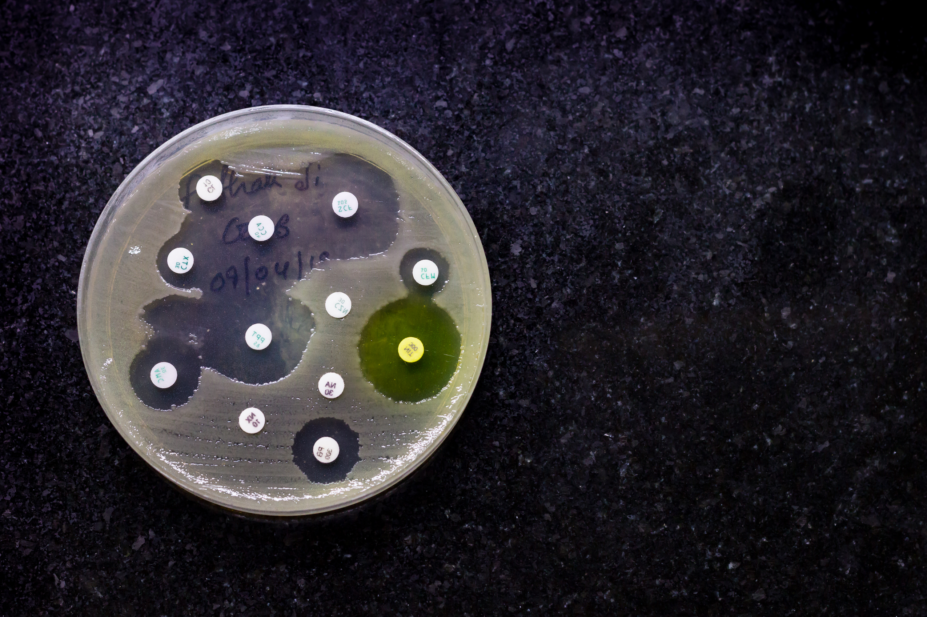 Agar Plate Dish Bacteria Resistant