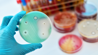 antimicrobial resistance testing in petri dish