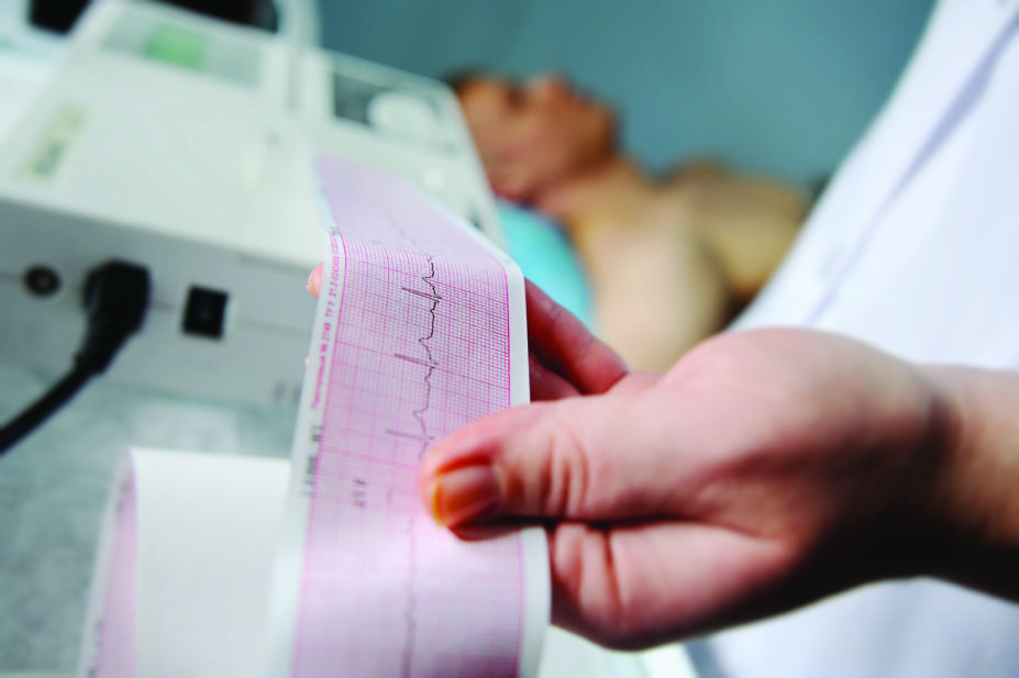 patient with arrhythmia undergoing ecg with printout