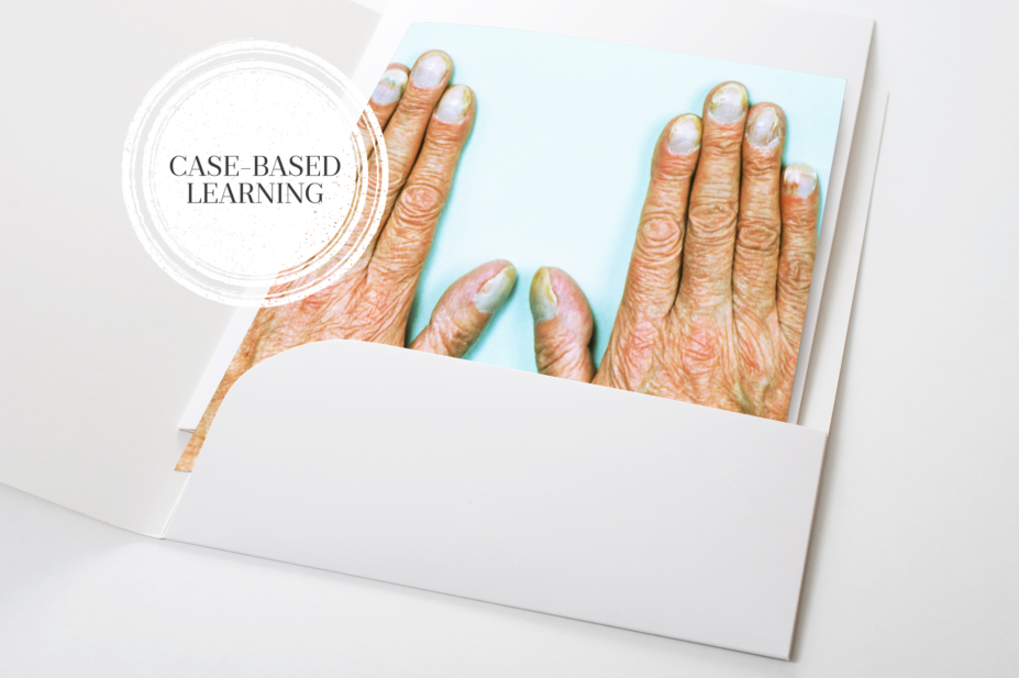 Case-based learning: recognising sepsis