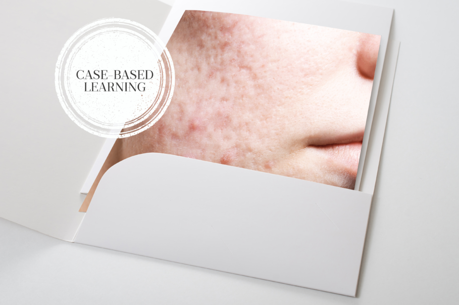 Case based learning acne