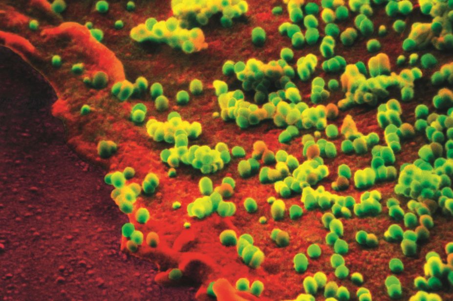 Coloured scanning electron micrograph (SEM) of the influenza virus on cell surface