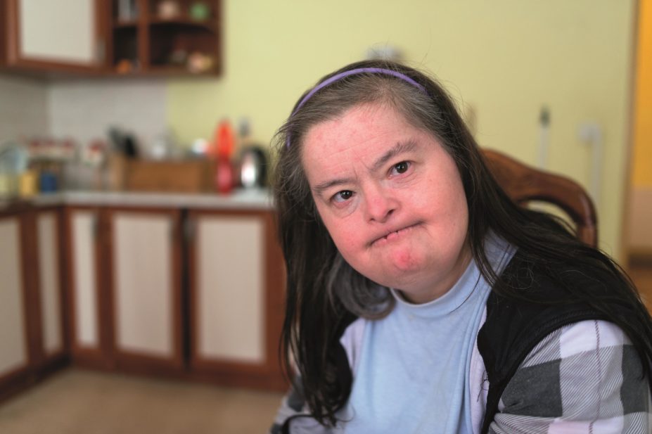 Down-syndrome-adult