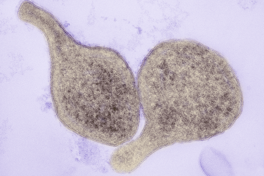 Electron micrograph of Mycoplasma genitalium