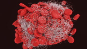 Fibrin forming a blood clot