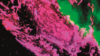 Heart failure fluorescent micrograph