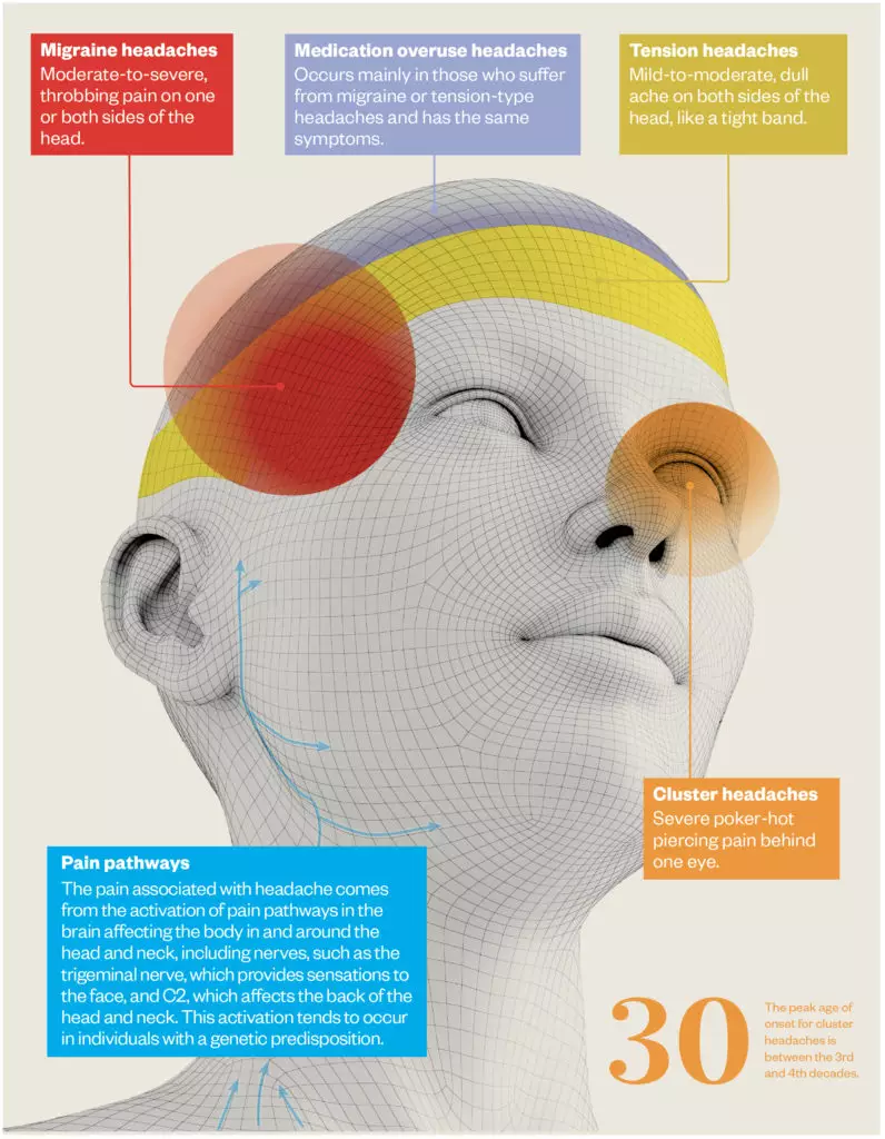 Headache: A Visual Guide - The Pharmaceutical Journal