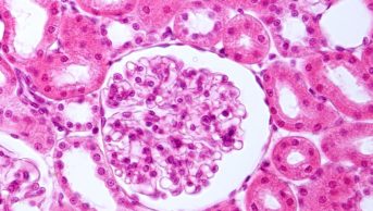 Damage to the cells comprising the glomerulus can result in nephrotic syndrome