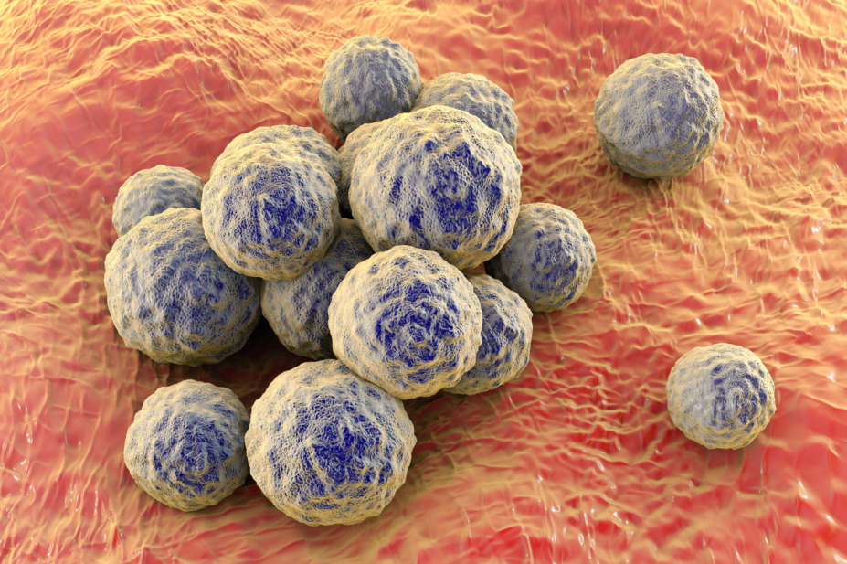 Methicillin-resistant Streptococcus aureus