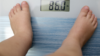 Obese child standing on scales