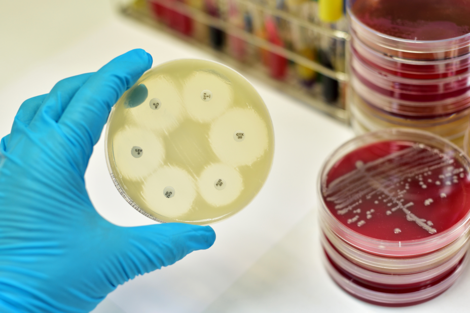 Testing antibiotic resistance in a petri dish