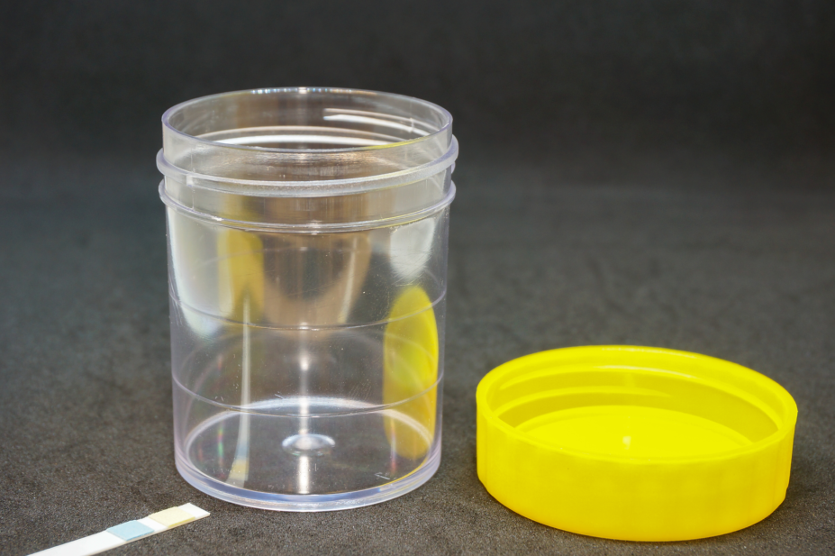Urine sample kit