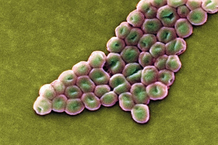 Micrograph of Acinetobacter baumannii bacteria