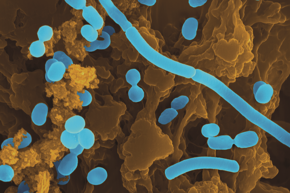 Acinetobacter SEM, gram-negative bacteria