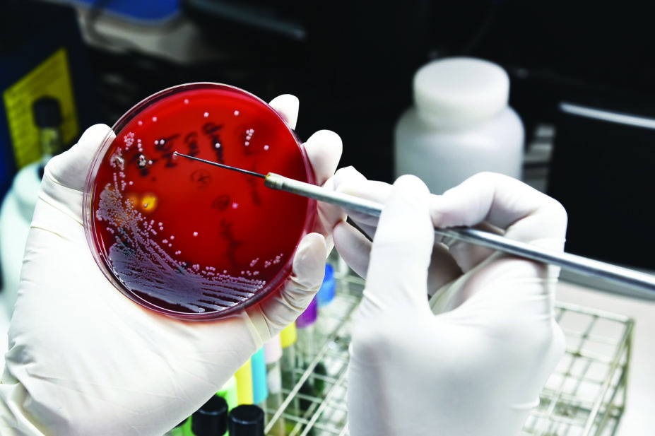 Bacterial culture in petri dish study in laboratory