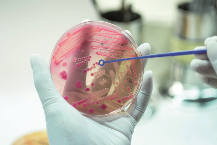 antimicrobial resistance petri dish culture