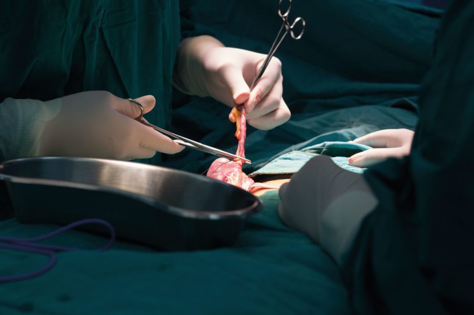 Surgeons perform an appendectomy