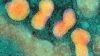 A suspected case of avian influenza (bird flu) has been reported on a poultry farm in Dunfermline in Fife, Scotland, the Scottish government has confirmed. In the image, micrograph of avian influenza virus particles