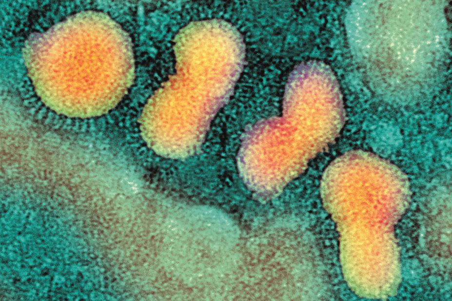 A suspected case of avian influenza (bird flu) has been reported on a poultry farm in Dunfermline in Fife, Scotland, the Scottish government has confirmed. In the image, micrograph of avian influenza virus particles