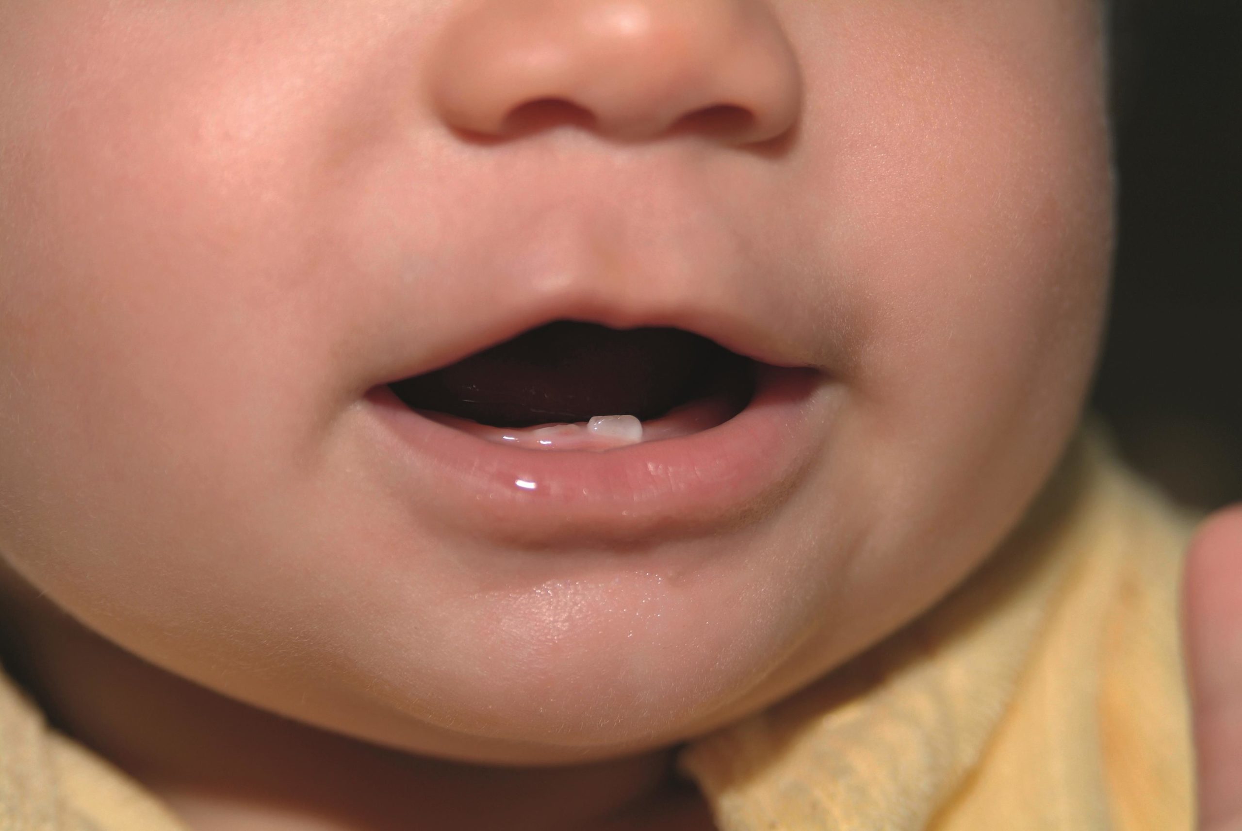 6 признаки зубов. Прорезывание зубов у младенцев. Прорезание первых зубов.