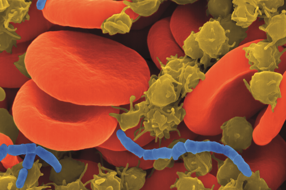 coloured scanning electron micrograph (SEM) of bacterial blood infection (sepsis) caused by a rod shaped bacterium (blue)