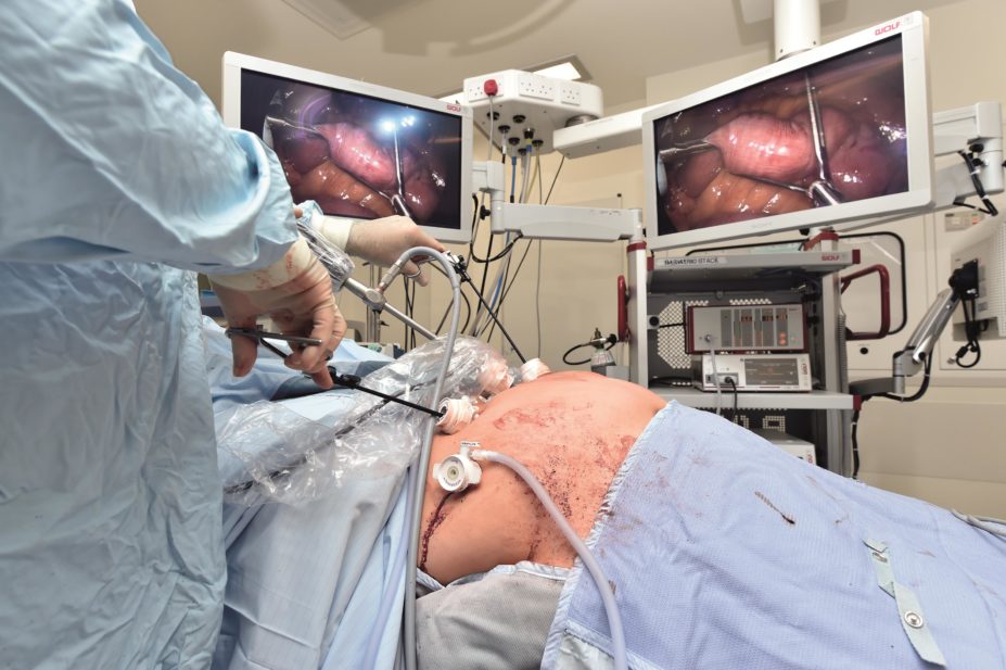 Gastric bypass surgery on obese patient