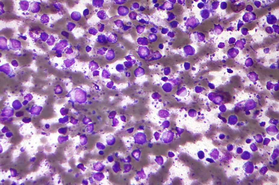 Researchers at US biotech company Genentech have developed a bispecific antibody that they say is highly active against leukaemia and lymphoma cells.