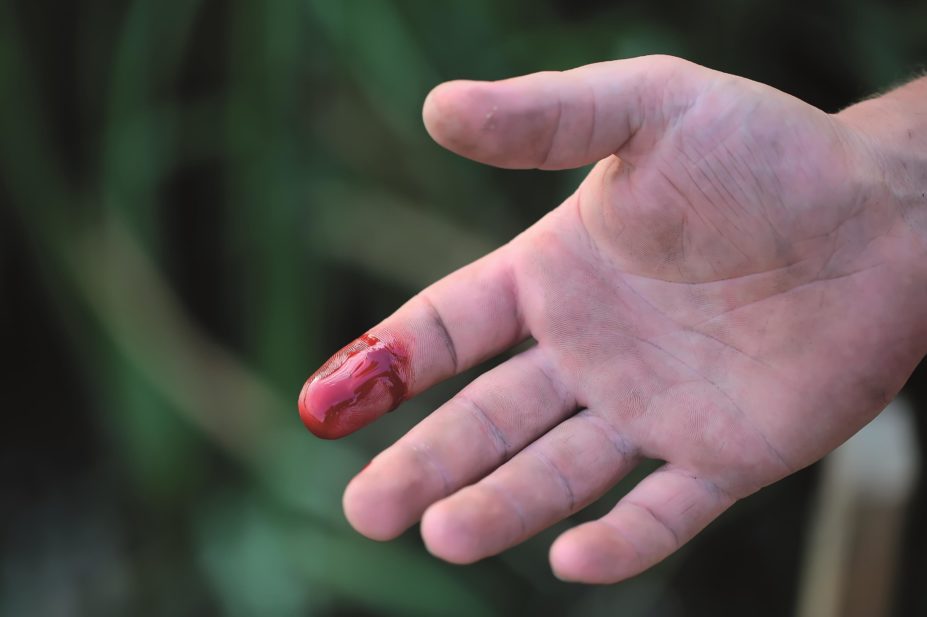 haemophilia-bleeding-finger