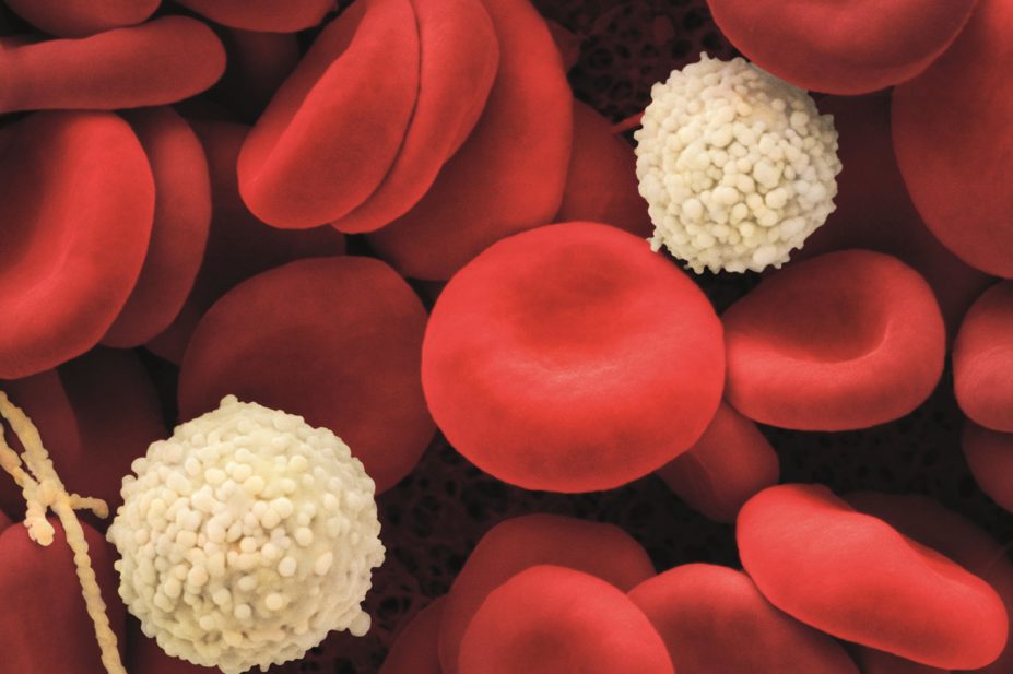 Scanning electron micrograph (SEM) of red blood cells. Iron deficiency anaemia is usually related to low intake of iron