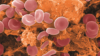 Blood clot micrograph