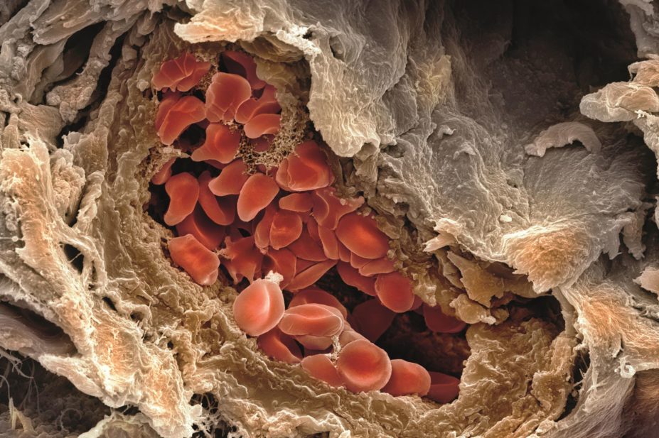 Micrograph of a blood filled micrograph