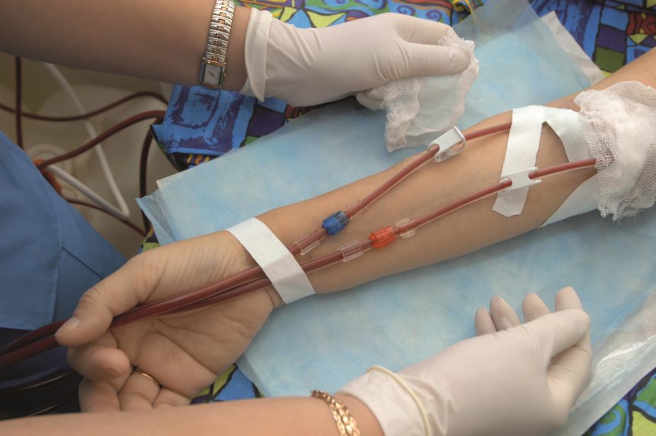 Use of tranexamic acid is inexpensive and has shown efficacy in reducing perioperative blood loss and the need for transfusions. In the image, a person has a blood transfusion