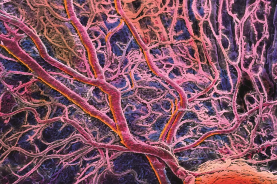 Blood vessels in the choroid of the eye