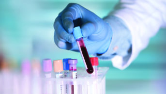blood from cancer patient in test-tube