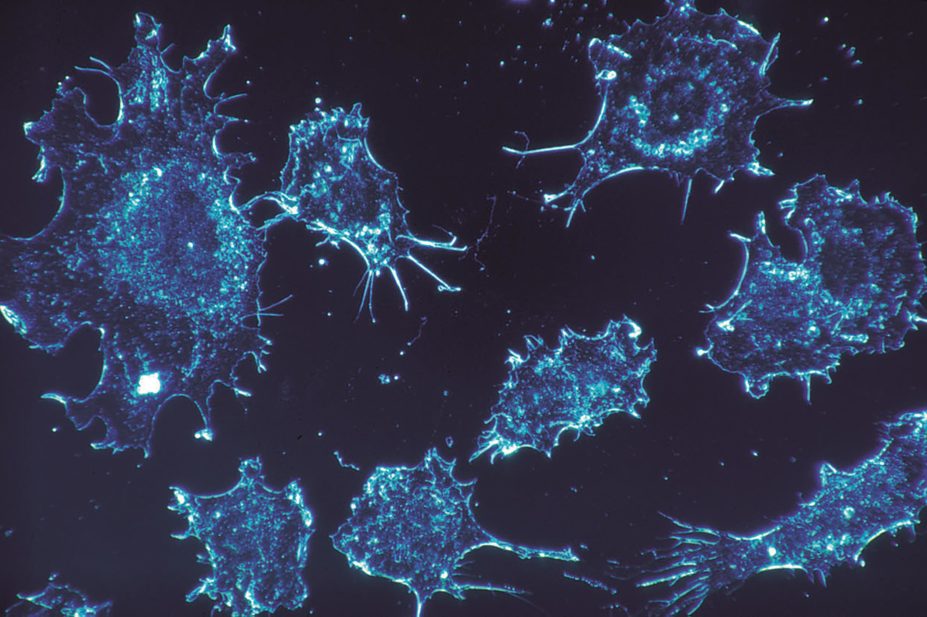 Scientists have created a therapy that could outsmart cancer cells (pictured) that are immune to certain treatments, according to a recent study