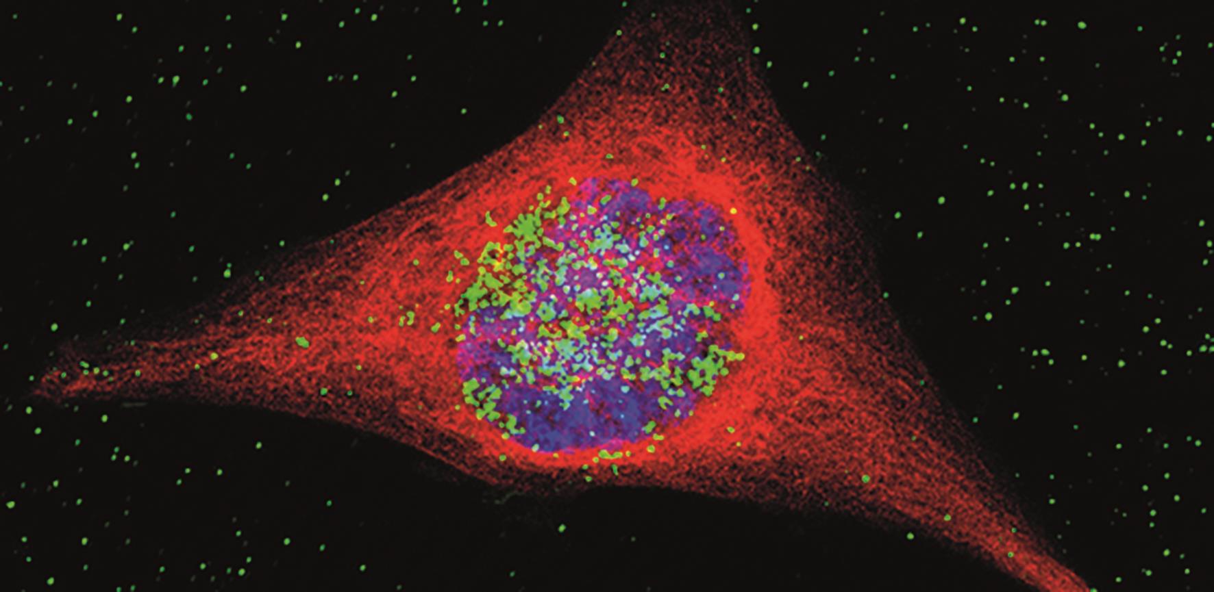 Scientists develop gold nanoparticles to deliver cisplatin - The ...