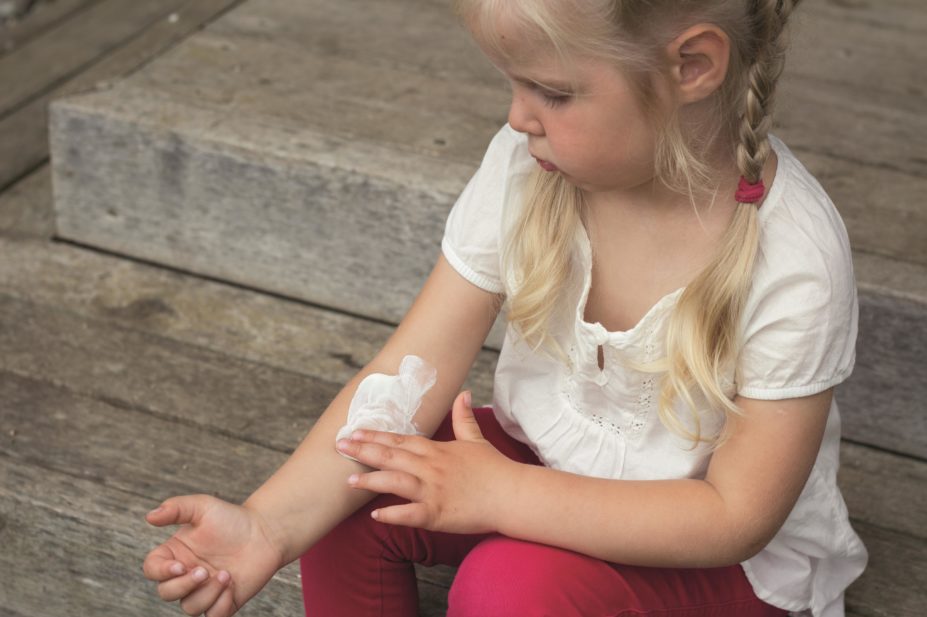 Child applying cream to a patch of skin with eczema
