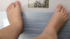 obesity in young child