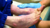 Close up of clinician checking patient's feet