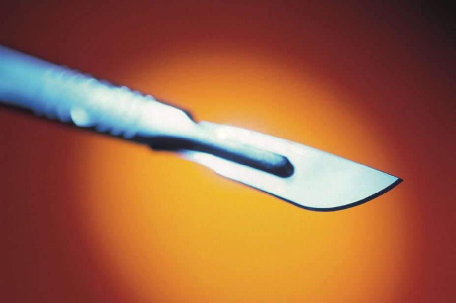 It revealed that funding for the pharmacy sector in England in 2016–2017 is set to be cut from £2.8bn to £2.63bn, a reduction of £170m (more than 6%). In the image, close-up of a surgical scalpel