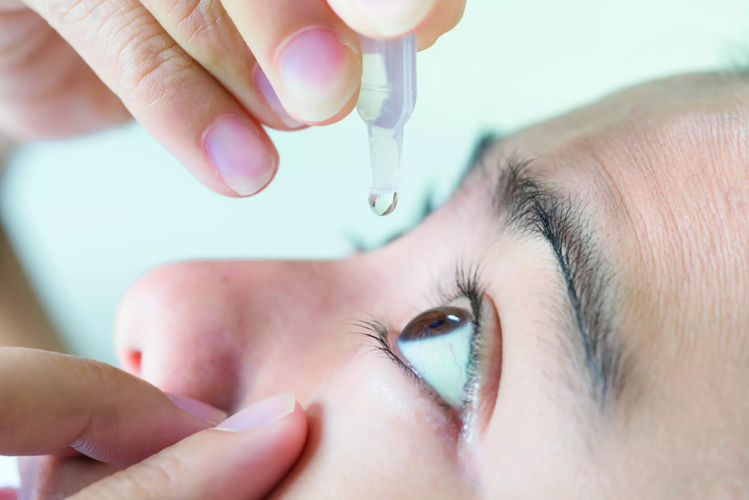 How Long Do You Use Antibiotic Eye Drops After Cataract Surgery