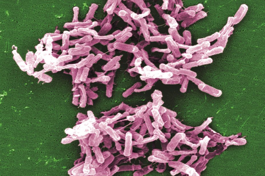 Micrograph of Clostridium difficile bacteria