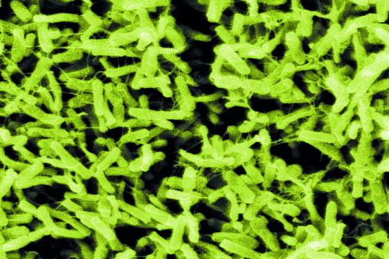 Clostridium difficile micrograph wi 17