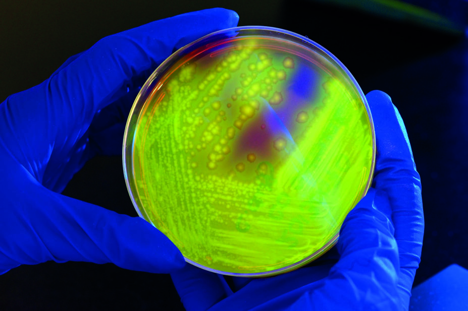 Petri dish with clostridium difficile culture