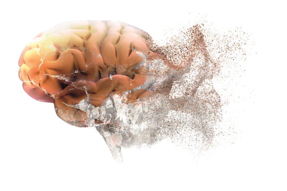 Evidence is emerging that some dementia cases could be prevented by leading a healthy lifestyle but long-term studies are needed to confirm the strength of the association. In the image, conceptual illustration of dementia - a disintegrating brain