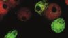 Dendritic cells under light fluorescence