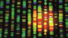 Patients with high and intermediate genetic risk for coronary heart disease benefit more from statin therapy than patients at low genetic risk, researchers have shown.