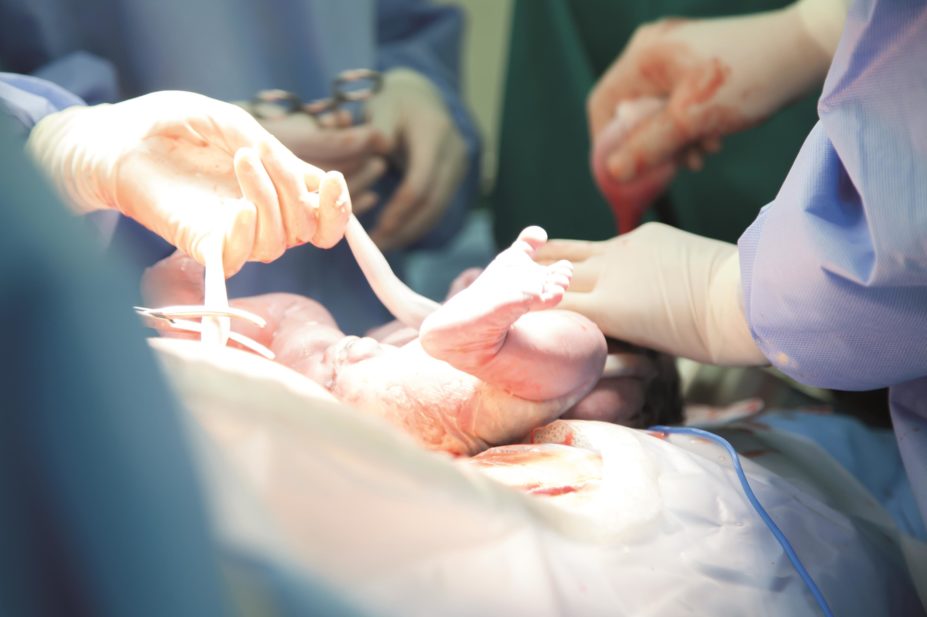 Doctor holds the umbilical cord of a newborn baby