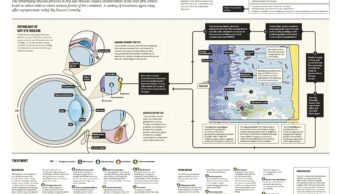 Infographic explaining the pathology and treatment types of dry eye disease